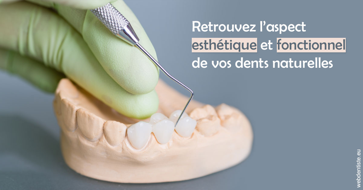 https://dr-meyer-eric.chirurgiens-dentistes.fr/Restaurations dentaires 1