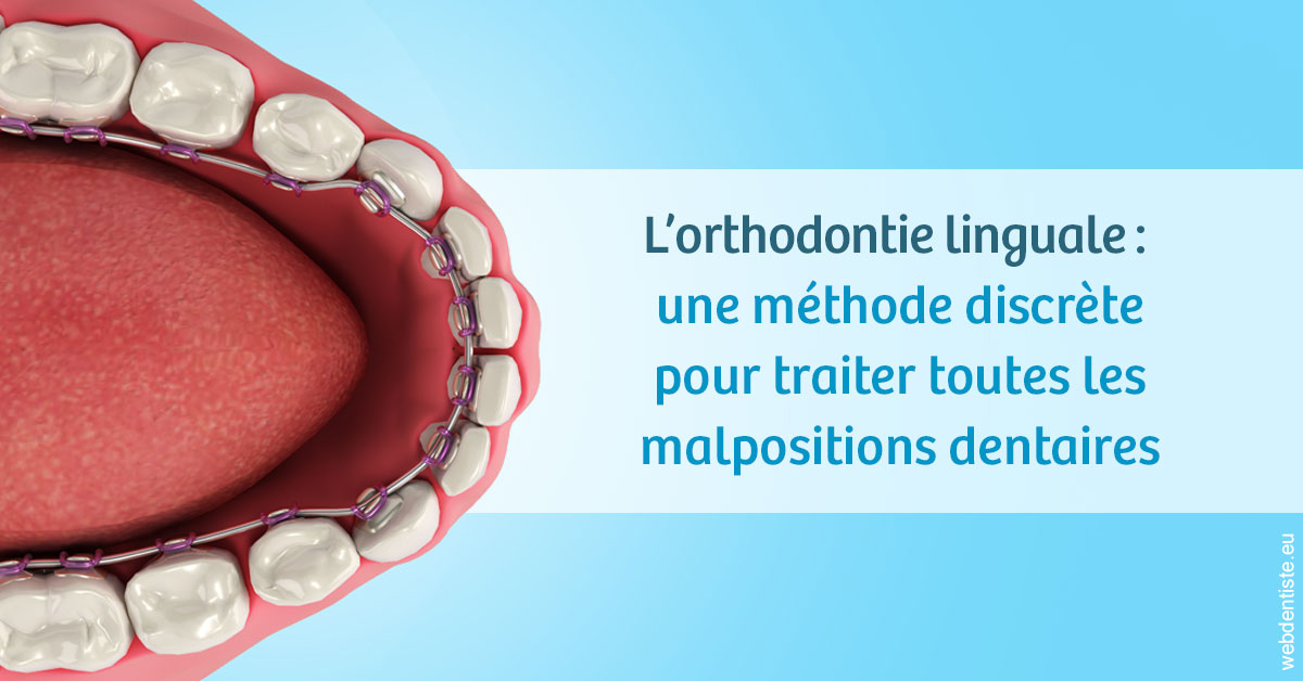 https://dr-meyer-eric.chirurgiens-dentistes.fr/L'orthodontie linguale 1