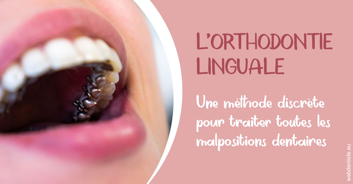 https://dr-meyer-eric.chirurgiens-dentistes.fr/L'orthodontie linguale 2