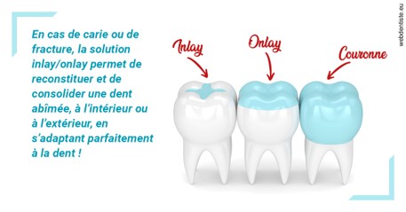 https://dr-meyer-eric.chirurgiens-dentistes.fr/L'INLAY ou l'ONLAY