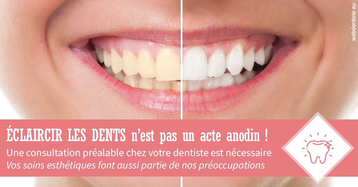 https://dr-meyer-eric.chirurgiens-dentistes.fr/Eclaircir les dents 1