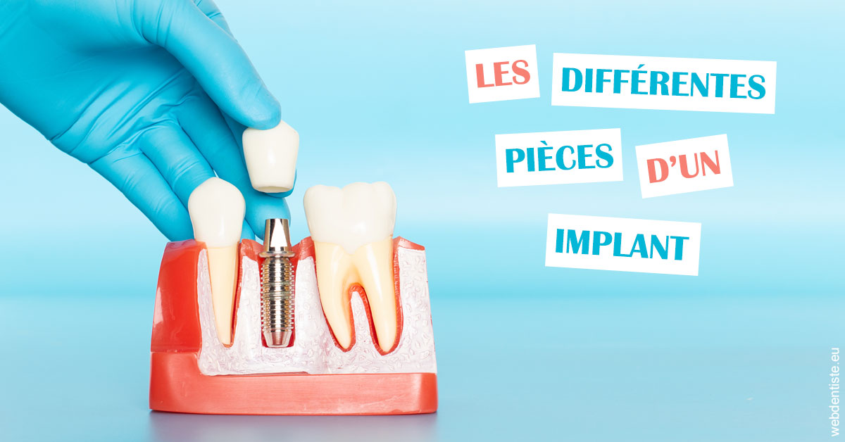 https://dr-meyer-eric.chirurgiens-dentistes.fr/Les différentes pièces d’un implant 2