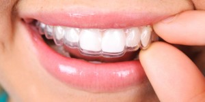 Autres techniques orthodontiques